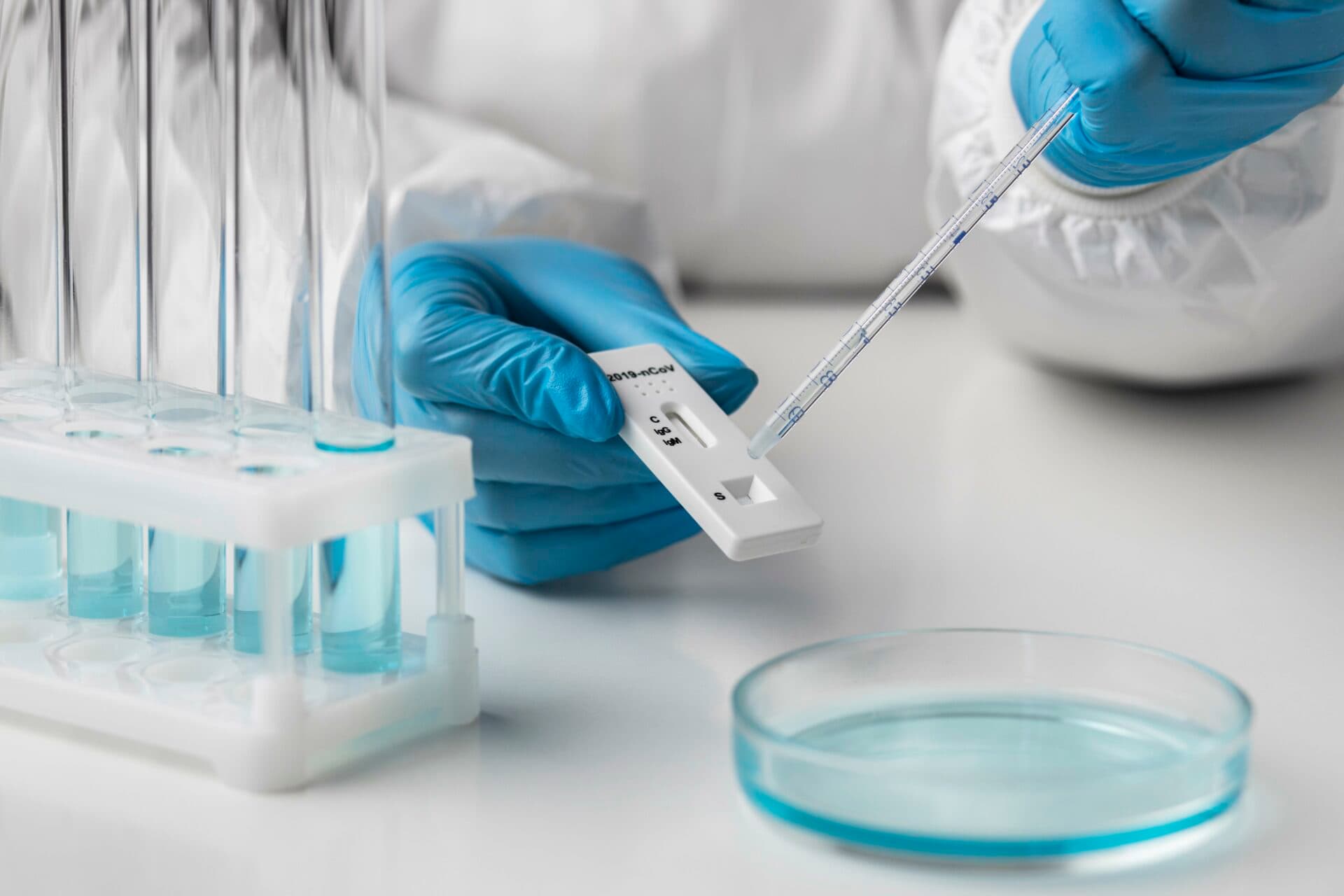 V nedeľu na Slovensku odhalili PCR testy 7 796 nakazených, pribudlo 13 obetí